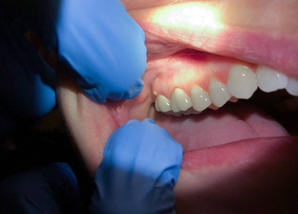 Best Emergency Dental Care for Trauma or Injury in Novato, CA